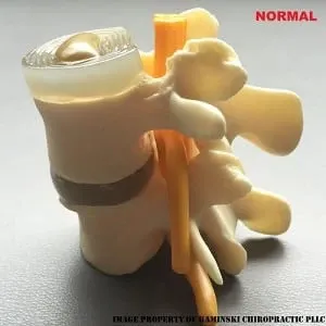 Chiropractic Grand Rapids MI Normal Vertebrae Anatomical model of a normal vertebra, showing standard spinal structure.